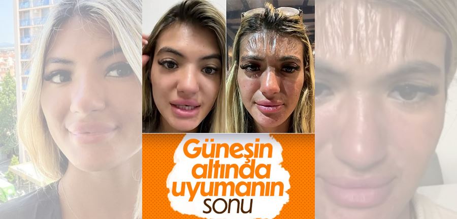 Güneşin altında uyuyan İngiliz kadının yüzündeki çarpıcı değişim