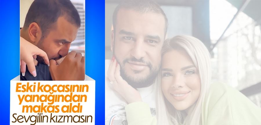 Damla Ersubaşı eski eşinin yanağından makas aldığı anları paylaştı