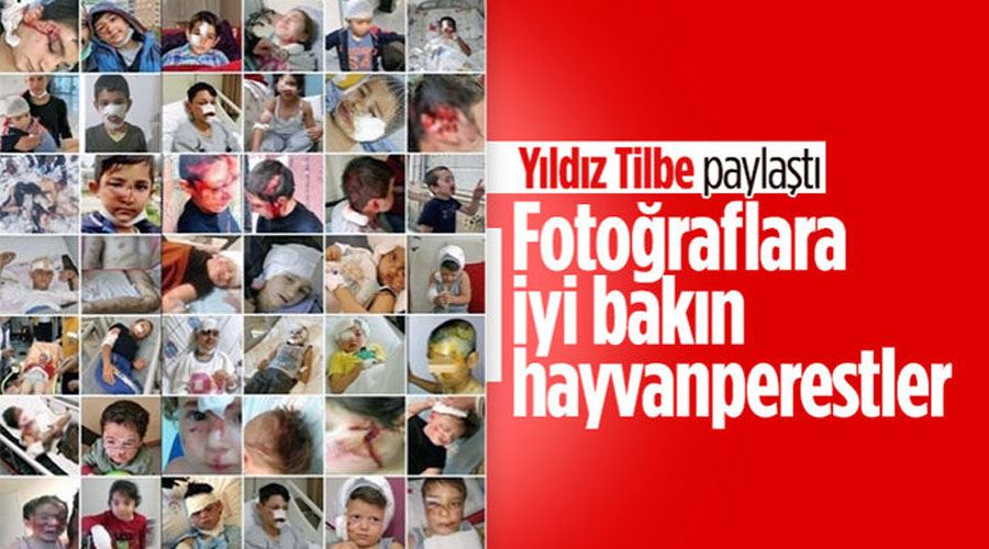 Yıldız Tilbe sokak köpeği mağduru çocukları paylaştı