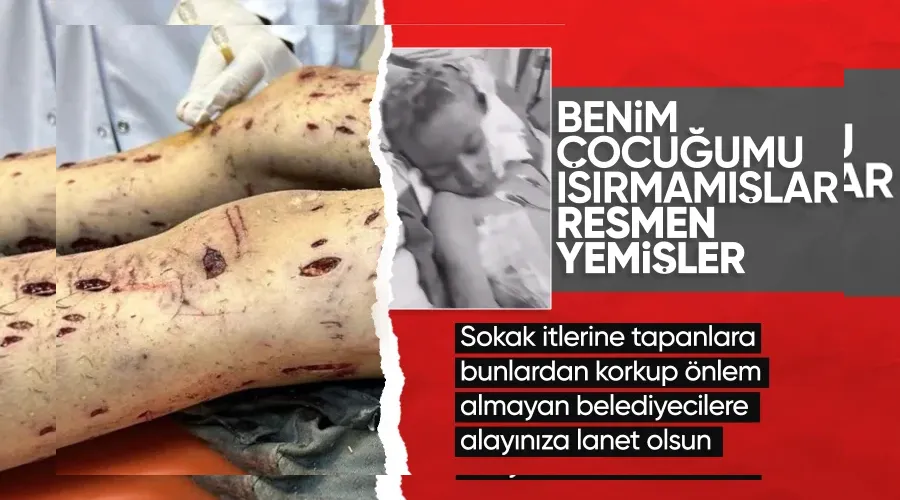 Köpeklerin saldırdığı Tunahan