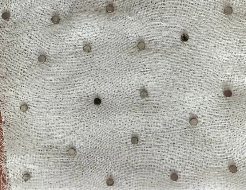 Çocuğun boğazından 19 adet mıknatıs çıkartıldı
