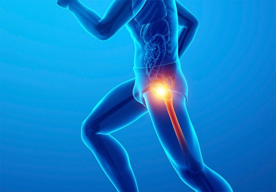 Kalça Labrum Yırtığı: İşte Bilmeniz Gerekenler!