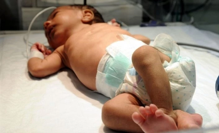 Her yıl yaklaşık 15 bin bebek doğumsal kalp hastalığıyla dünyaya geliyor