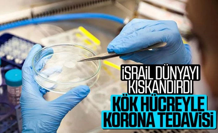 İsrail korona hastalarını kök hücre tedavisiyle iyileştirdi