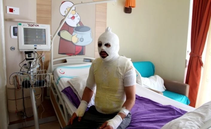 Akrabaları tarafından kaynar suyla yakıldığını iddia etti