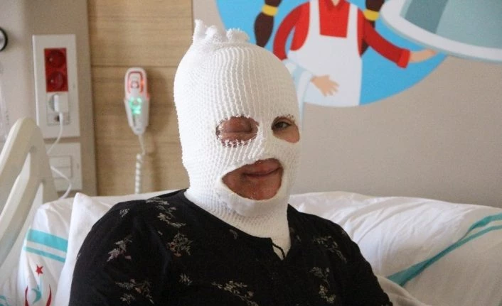 Başından aşağıya çaydanlık dökülen kadın feci şekilde yandı